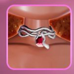 Snake necklace in DTI