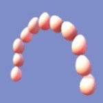 Sunny side up arch in DDV.