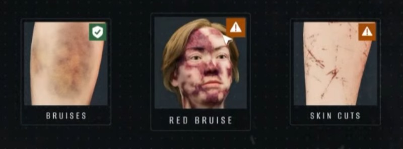 all bruising symptoms and markings in quarantine zone